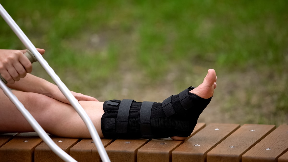 ankle fracture recovery