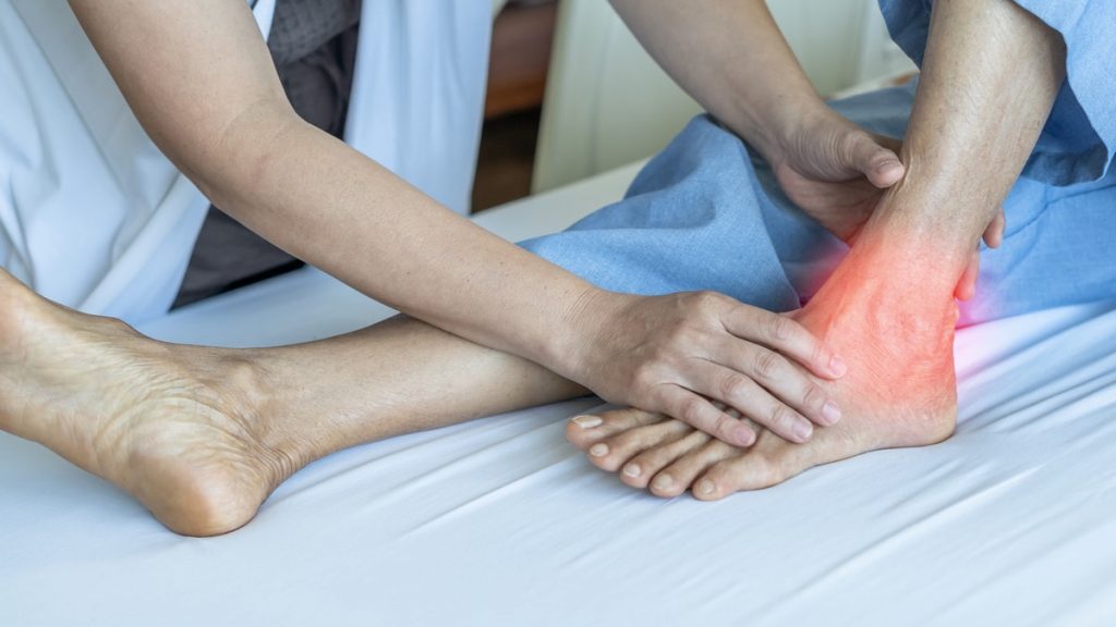 Achilles Tendon Rupture: Symptoms, Treatment, Recovery | HSS