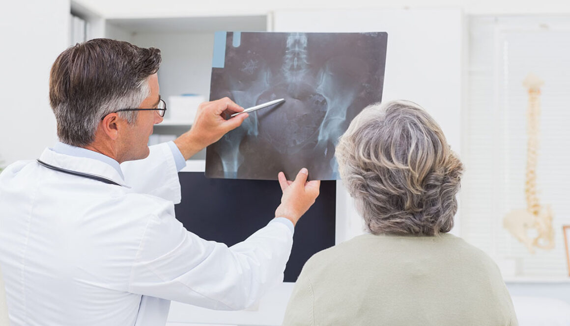 An Orthopedic Doctor Explaining a Hip X-Ray to a Senior Woman Patient Independent Orthopedic Practices