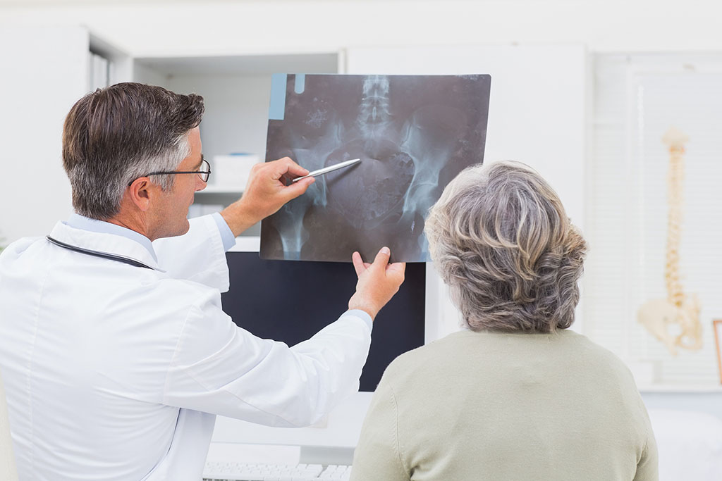 An Orthopedic Doctor Explaining a Hip X-Ray to a Senior Woman Patient Independent Orthopedic Practices