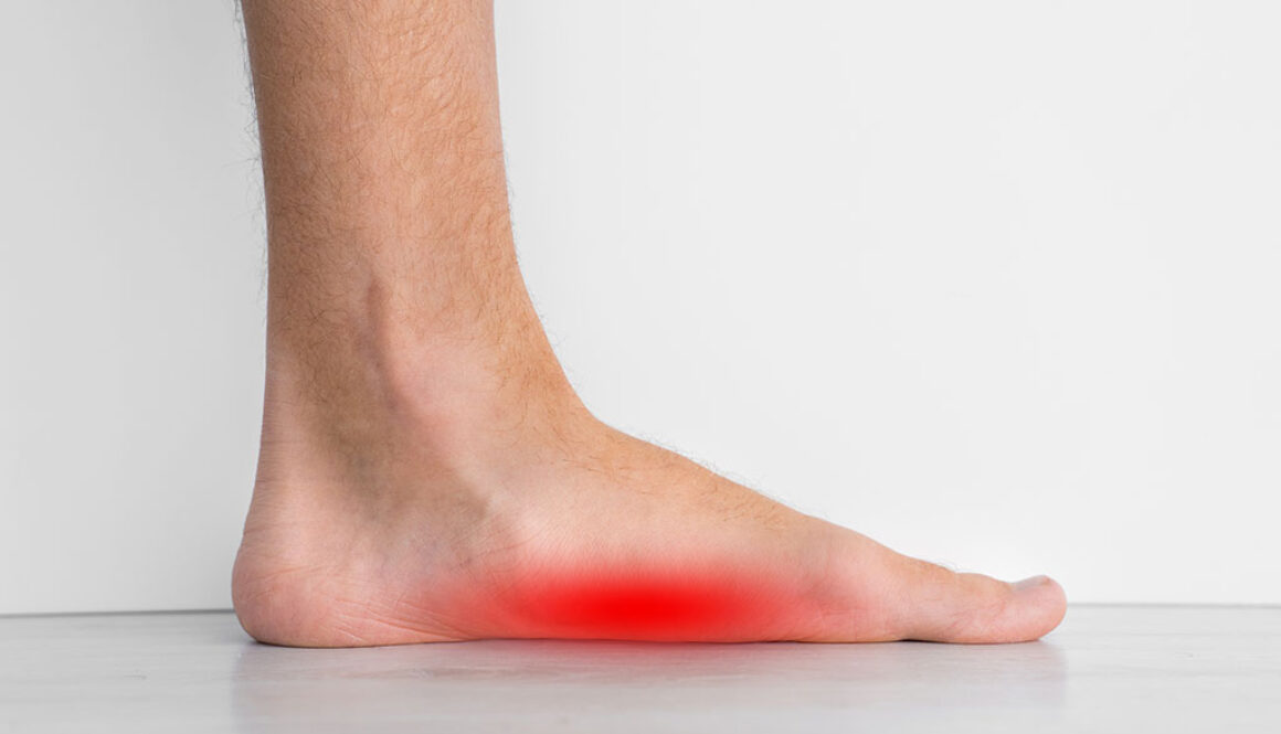 Closeup Of A Foot That Is Flat With A Red Area Highlighting Foot Pain From Flat Feet